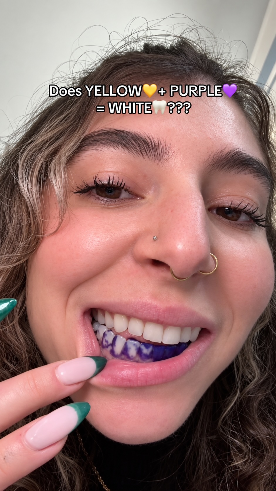 Teeth Whitening Review