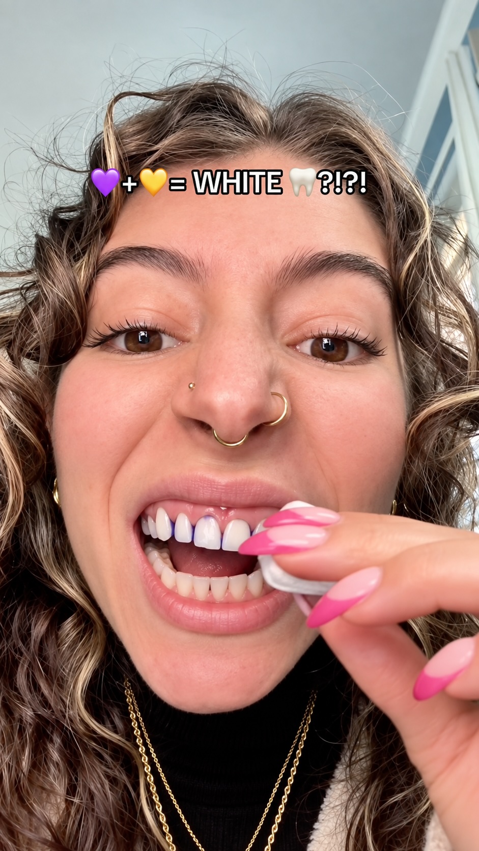 Teeth Whitening Solution