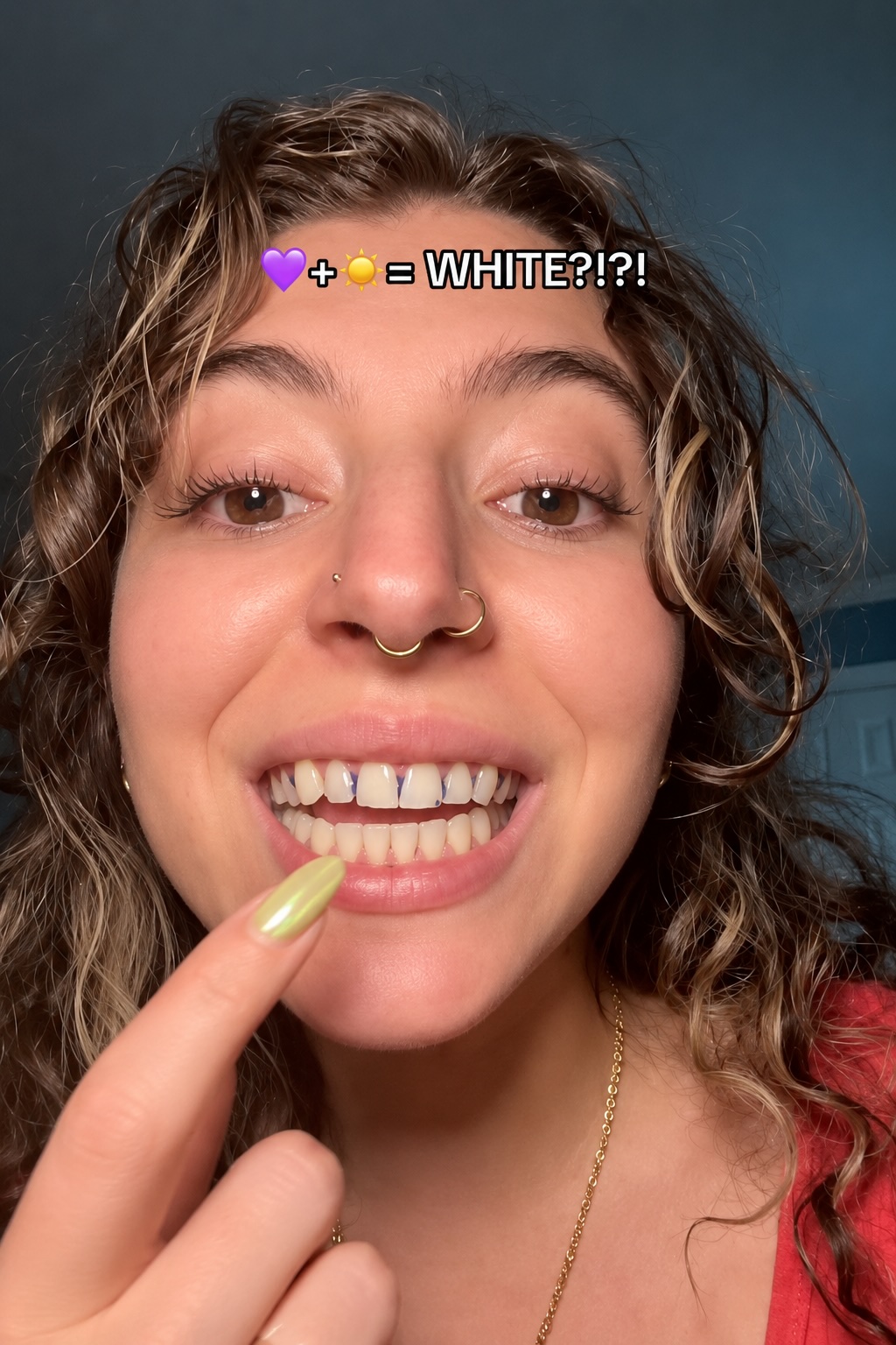 Dr. Dent Teeth Whitening